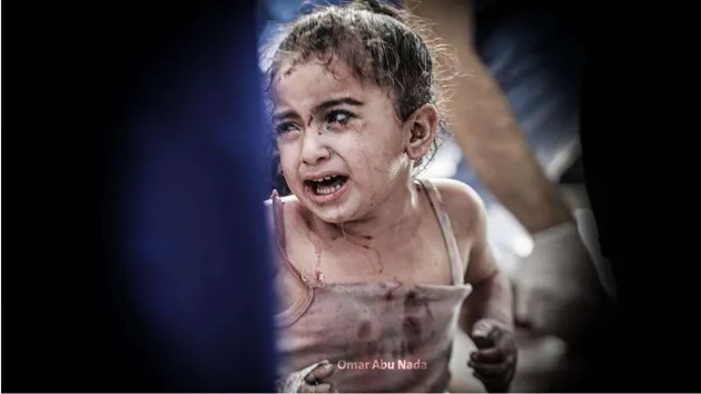 عدد القتلى الأطفال بغزة في أقل من شهر 10 أضعاف نظرائهم الأوكرانيين في عام