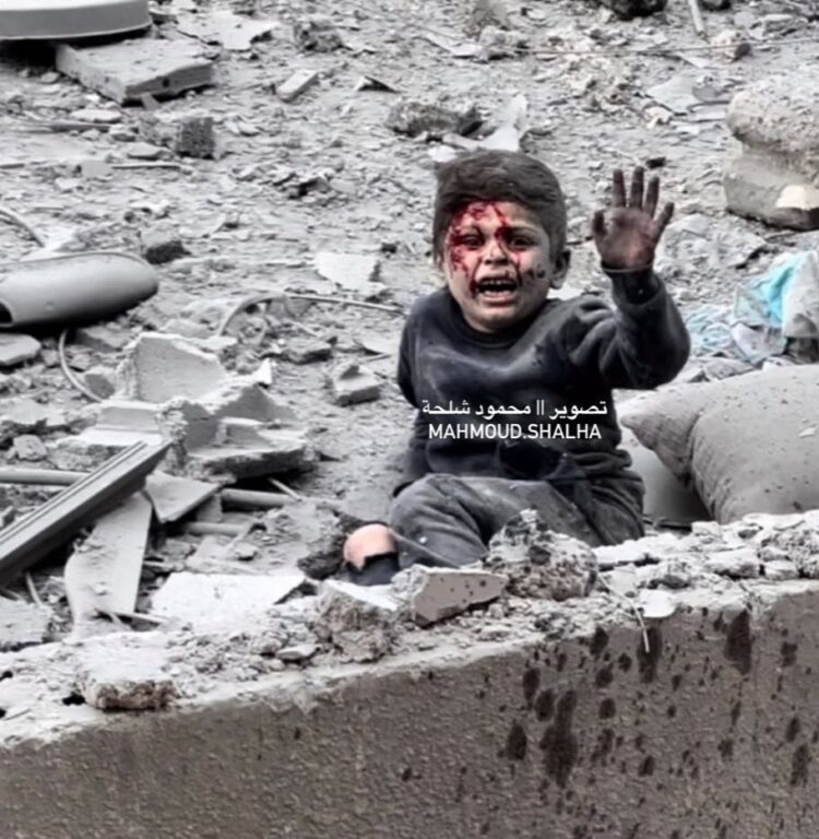 طفل مصاب يستغيث وسط ركام الموت في غزة