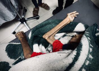 خلال 48 ساعة.. 20 شهيدًا في غزة بحرب التجويع
