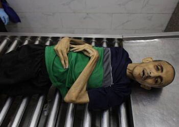 4 وفيات جديدة بسبب التجويع والحصار في غزة