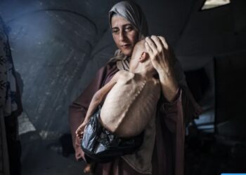 5 وفيات بسبب المجاعة وسوء التغذية في قطاع غزة خلال 24 ساعة