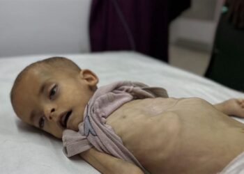 "اليونيسف": 112 طفلًا في غزة يعانون من سوء التغذية يوميًا