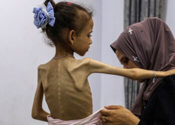 صحة غزة: ارتفاع حصيلة وفيات التجويع إلى 313 بينهم 119 طفلا #عاجل